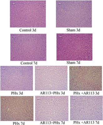 Lactiplantibacillus plantarum AR113 Exhibit Accelerated Liver Regeneration by Regulating Gut Microbiota and Plasma Glycerophospholipid